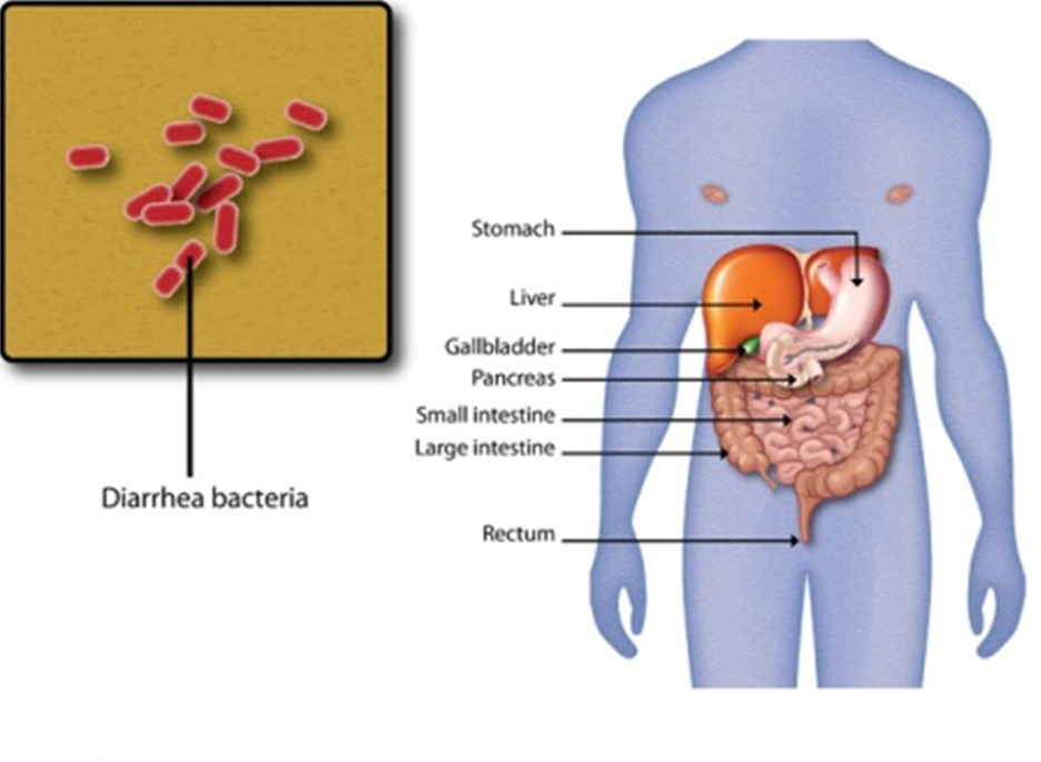 （认证版）rBS疫苗与儿童细菌性腹泻防制